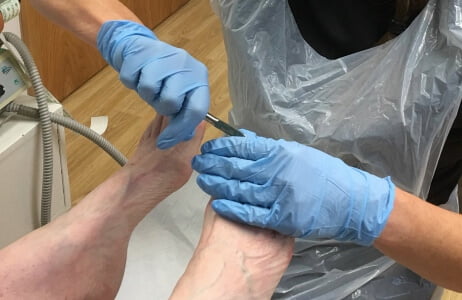 Close up photo of podiatrist hands working